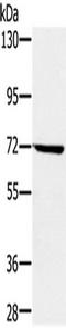 Nucleoporin 85 antibody, TA350270, Origene, Western Blot image 