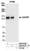 U2 SnRNP Associated SURP Domain Containing antibody, A304-617A, Bethyl Labs, Immunoprecipitation image 