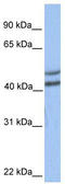 Galactose-1-phosphate uridylyltransferase antibody, TA346668, Origene, Western Blot image 