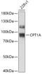 Carnitine Palmitoyltransferase 1A antibody, 19-575, ProSci, Western Blot image 