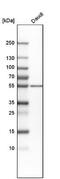 Protein Kinase CAMP-Dependent Type II Regulatory Subunit Beta antibody, NBP1-80879, Novus Biologicals, Western Blot image 