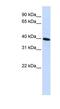 NAD(P)HX Dehydratase antibody, NBP1-62516, Novus Biologicals, Western Blot image 