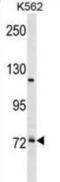 Pre-MRNA Processing Factor 39 antibody, abx031405, Abbexa, Western Blot image 
