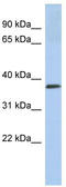 Calreticulin 3 antibody, TA344272, Origene, Western Blot image 