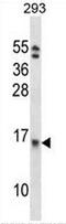 Eukaryotic Translation Initiation Factor 1B antibody, AP51389PU-N, Origene, Western Blot image 