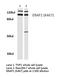 Endoplasmic Reticulum Aminopeptidase 1 antibody, LS-C176836, Lifespan Biosciences, Western Blot image 