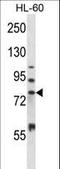 Matrix Metallopeptidase 15 antibody, LS-C164237, Lifespan Biosciences, Western Blot image 