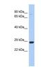 Chromosome 21 Open Reading Frame 91 antibody, NBP1-56533, Novus Biologicals, Western Blot image 