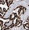 Mago Homolog, Exon Junction Complex Subunit antibody, FNab04954, FineTest, Immunohistochemistry paraffin image 