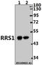 Ribosome Biogenesis Regulator 1 Homolog antibody, A04418-1, Boster Biological Technology, Western Blot image 