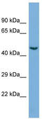 Cyclin Dependent Kinase 19 antibody, TA334062, Origene, Western Blot image 
