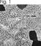 ATPase Sarcoplasmic/Endoplasmic Reticulum Ca2+ Transporting 1 antibody, NB120-2818, Novus Biologicals, Immunohistochemistry paraffin image 
