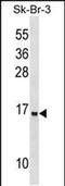 Urp antibody, PA5-48878, Invitrogen Antibodies, Western Blot image 