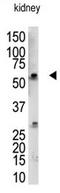 RANBP2-Type And C3HC4-Type Zinc Finger Containing 1 antibody, AP11958PU-N, Origene, Western Blot image 