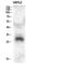 C-Type Lectin Domain Family 4 Member A antibody, A08158, Boster Biological Technology, Western Blot image 