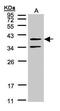 Galanin receptor type 2 antibody, PA5-21311, Invitrogen Antibodies, Western Blot image 