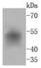 FosB Proto-Oncogene, AP-1 Transcription Factor Subunit antibody, NBP2-67710, Novus Biologicals, Western Blot image 
