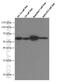 Lysophosphatidylcholine Acyltransferase 1 antibody, 66044-1-Ig, Proteintech Group, Western Blot image 