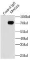 Sperm Associated Antigen 16 antibody, FNab08140, FineTest, Immunoprecipitation image 