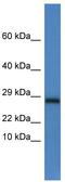 NADH:Ubiquinone Oxidoreductase Core Subunit V2 antibody, TA344741, Origene, Western Blot image 