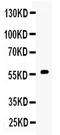 Cytochrome P450 Family 17 Subfamily A Member 1 antibody, A00615-1, Boster Biological Technology, Western Blot image 