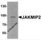 Janus Kinase And Microtubule Interacting Protein 2 antibody, 7167, ProSci Inc, Western Blot image 