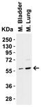 P21 (RAC1) Activated Kinase 2 antibody, A01419-2, Boster Biological Technology, Western Blot image 