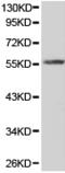 RAD9 Checkpoint Clamp Component A antibody, TA324191, Origene, Western Blot image 