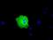Peroxisomal targeting signal 1 receptor antibody, GTX83905, GeneTex, Immunofluorescence image 