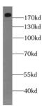 Dedicator of cytokinesis protein 1 antibody, FNab02492, FineTest, Western Blot image 