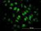 Scaffold Attachment Factor B antibody, H00006294-M04, Novus Biologicals, Immunocytochemistry image 