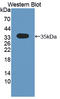 Cytokine receptor-like factor 1 antibody, LS-C373347, Lifespan Biosciences, Western Blot image 