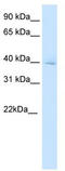 Diencephalon/mesencephalon homeobox protein 1 antibody, TA329975, Origene, Western Blot image 