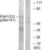 Alpha-PAK antibody, LS-C199400, Lifespan Biosciences, Western Blot image 
