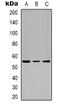 Desmoglein-3 antibody, orb388051, Biorbyt, Western Blot image 