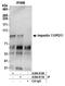Importin 11 antibody, A304-811A, Bethyl Labs, Immunoprecipitation image 