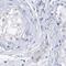 Chromosome 1 Open Reading Frame 87 antibody, PA5-56718, Invitrogen Antibodies, Immunohistochemistry frozen image 