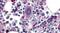 PAR-1 antibody, PA5-34263, Invitrogen Antibodies, Immunohistochemistry frozen image 