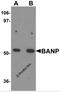 Protein BANP antibody, 5977, ProSci Inc, Western Blot image 