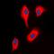 Zeta Chain Of T Cell Receptor Associated Protein Kinase 70 antibody, orb214753, Biorbyt, Immunofluorescence image 
