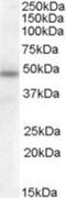 Serpin Family A Member 12 antibody, NBP1-20972, Novus Biologicals, Western Blot image 