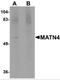 Matrilin 4 antibody, 5115, ProSci Inc, Western Blot image 