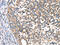 2,4-Dienoyl-CoA Reductase 1 antibody, CSB-PA040684, Cusabio, Immunohistochemistry paraffin image 