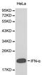 Interferon alpha-1 antibody, LS-C192612, Lifespan Biosciences, Western Blot image 
