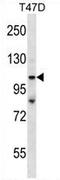 Tumor Protein P53 Binding Protein 2 antibody, AP54338PU-N, Origene, Western Blot image 