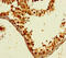 General Transcription Factor IIB antibody, A54471-100, Epigentek, Immunohistochemistry paraffin image 