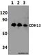 Cadherin 13 antibody, A01986, Boster Biological Technology, Western Blot image 