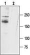 Sodium channel protein type 11 subunit alpha antibody, TA329040, Origene, Western Blot image 