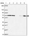 Phenylalanyl-tRNA synthetase beta chain antibody, PA5-63954, Invitrogen Antibodies, Western Blot image 
