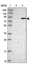 Bardet-Biedl Syndrome 7 antibody, NBP1-88690, Novus Biologicals, Western Blot image 